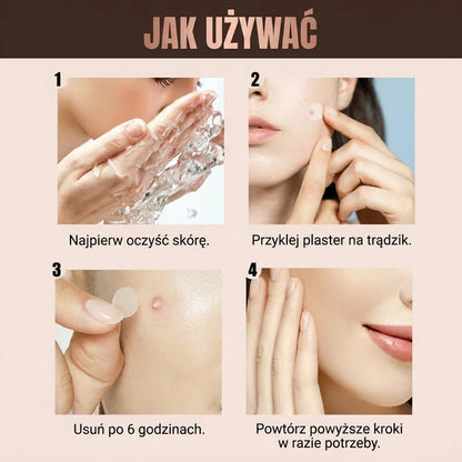 Plasterki hydrokoloidowe na niedoskonałości – 144 szt.