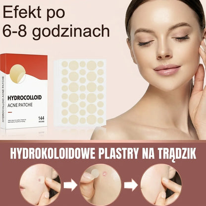 Plasterki hydrokoloidowe na niedoskonałości – 144 szt.